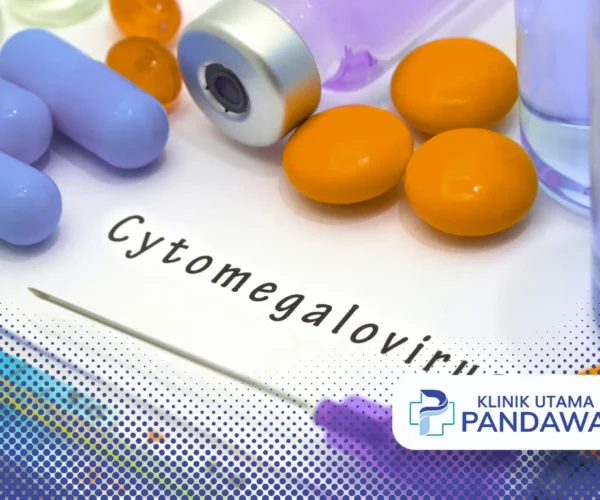 Cytomegalovirus