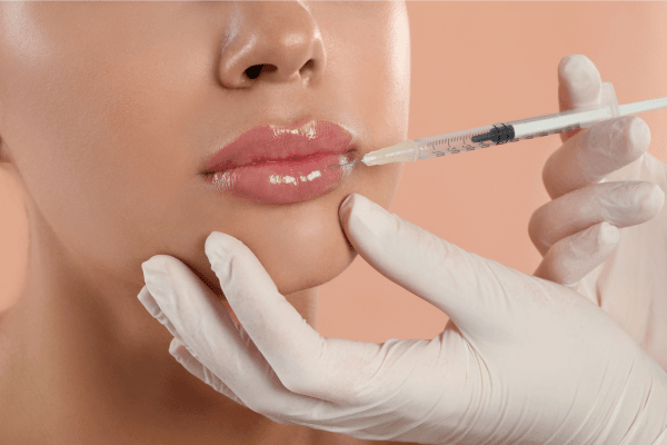 Filler bibir (2)