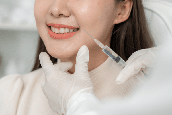 Filler smile line