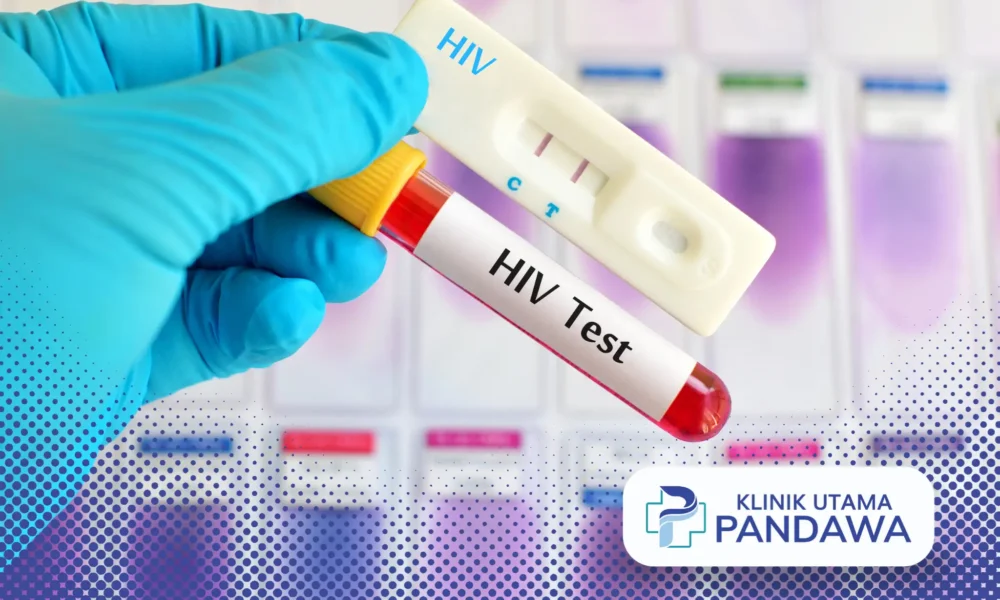 HIV