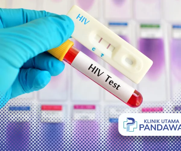 HIV