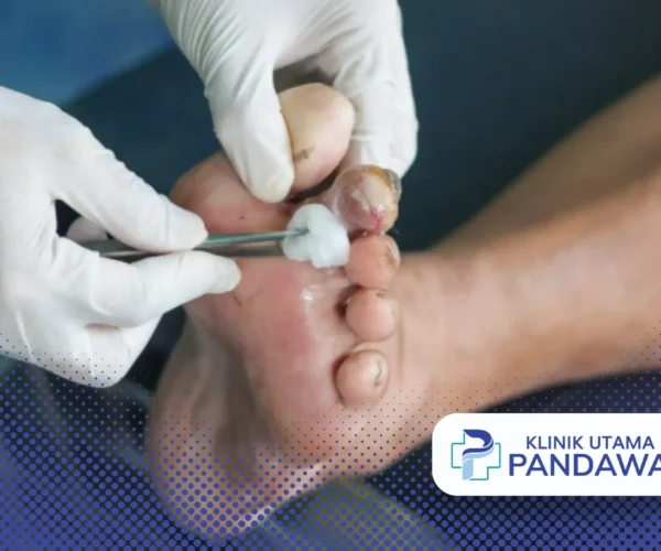 debridement adalah
