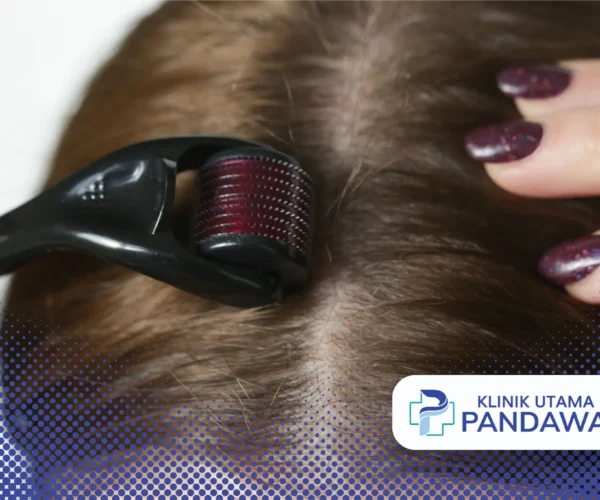dermaroller untuk rambut