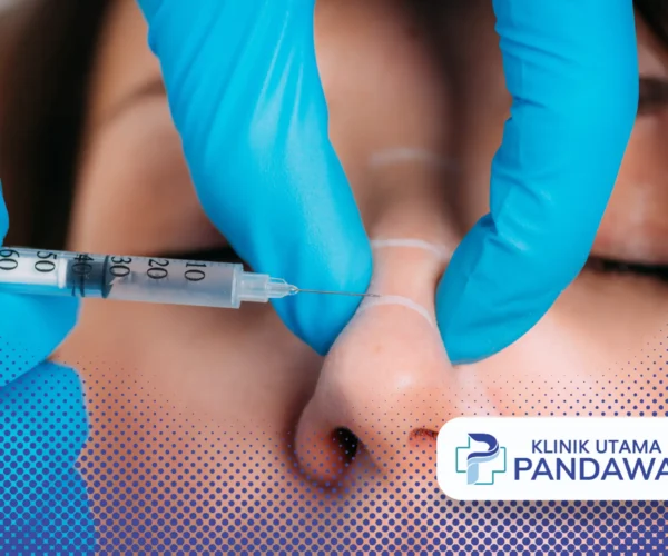 harga filler hidung