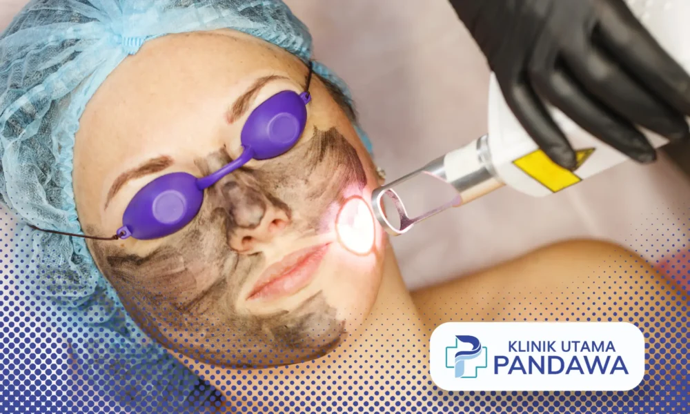 laser rejuvenation