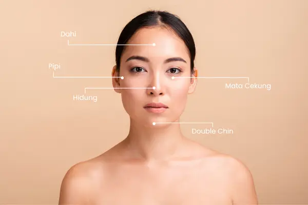 product threadlift