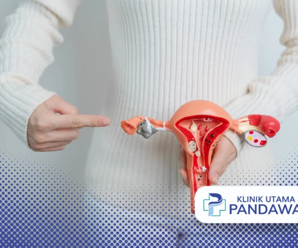 tumor fibroid