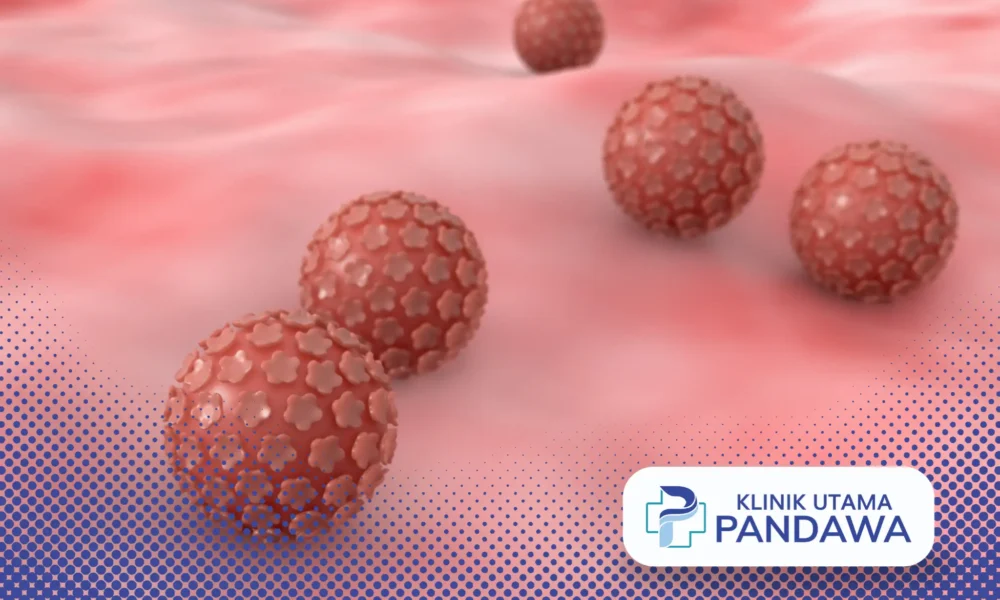 virus human papiloma dapat menyebabkan penyakit