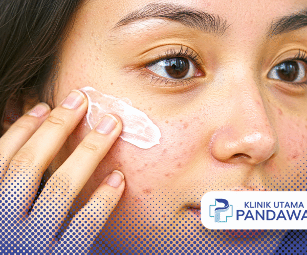 acne prone skin adalah