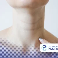 benjolan di leher belakang