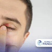 kelopak mata bengkak