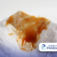 keputihan berwarna coklat