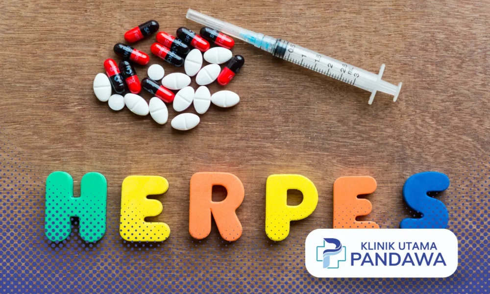 obat herpes