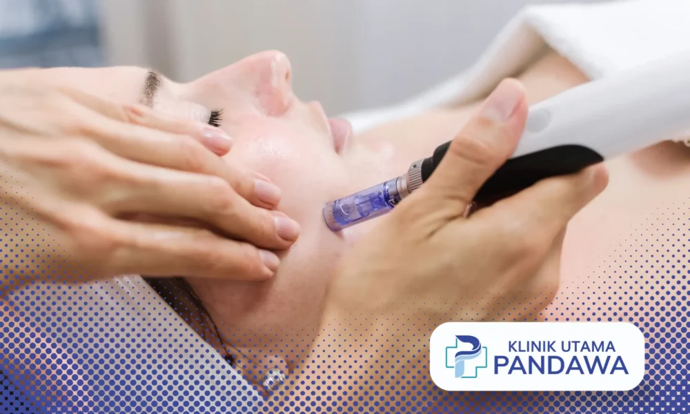 pantangan setelah dermapen