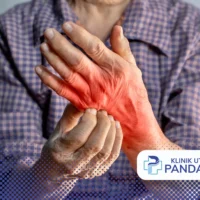 telapak tangan kiri gatal