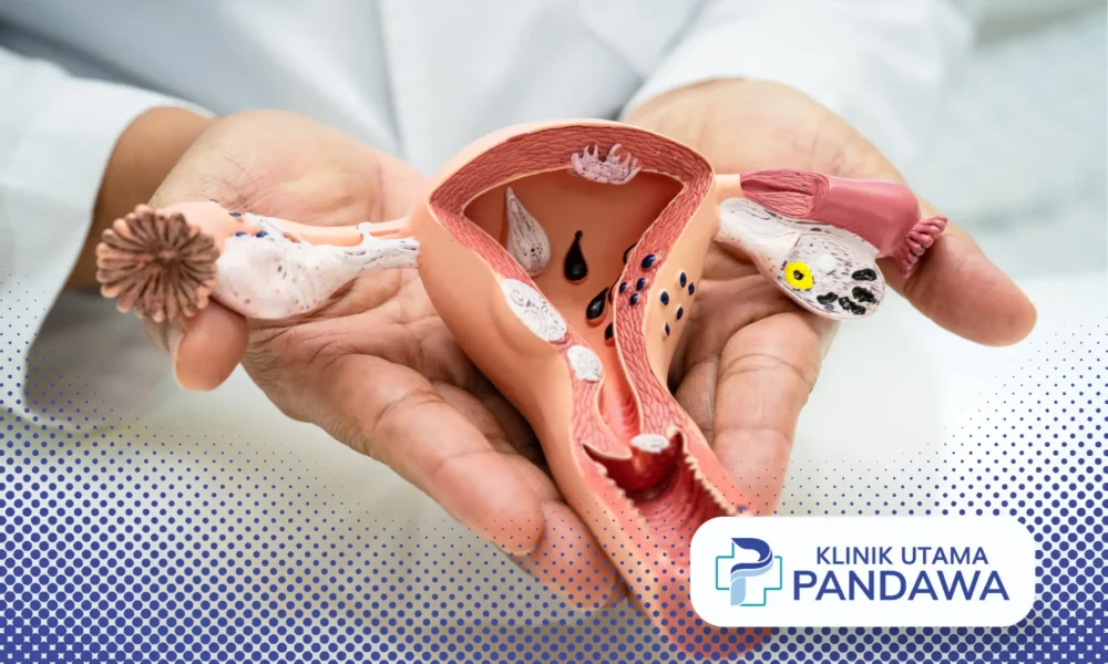 endometritis adalah