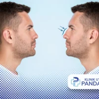 perbedaan hidung mancung dan pesek