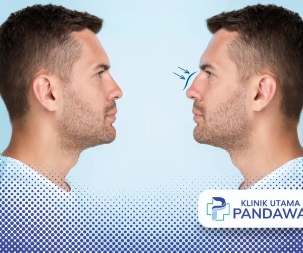 perbedaan hidung mancung dan pesek